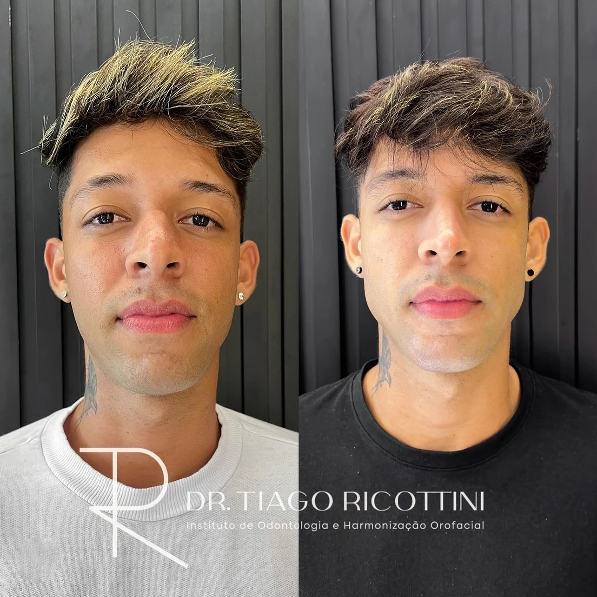 Copy of Facetune_14-09-2024-11-36-53 (1)
