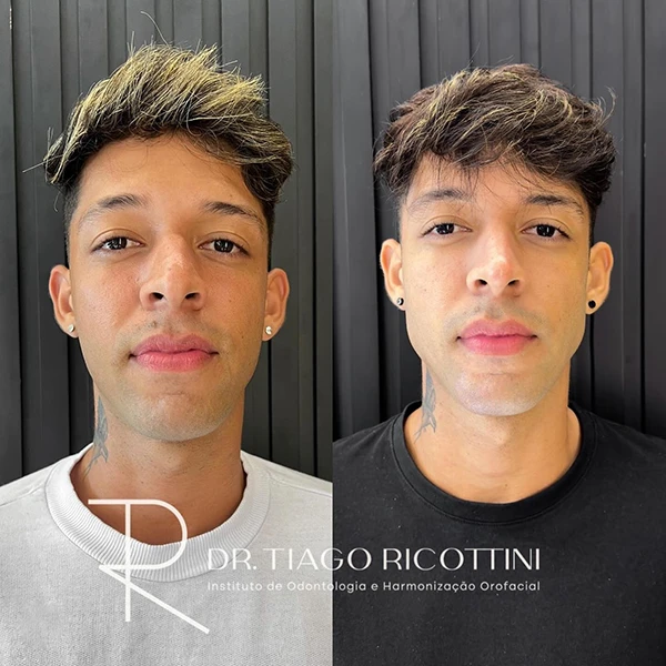 Copy of Facetune_14-09-2024-11-36-53