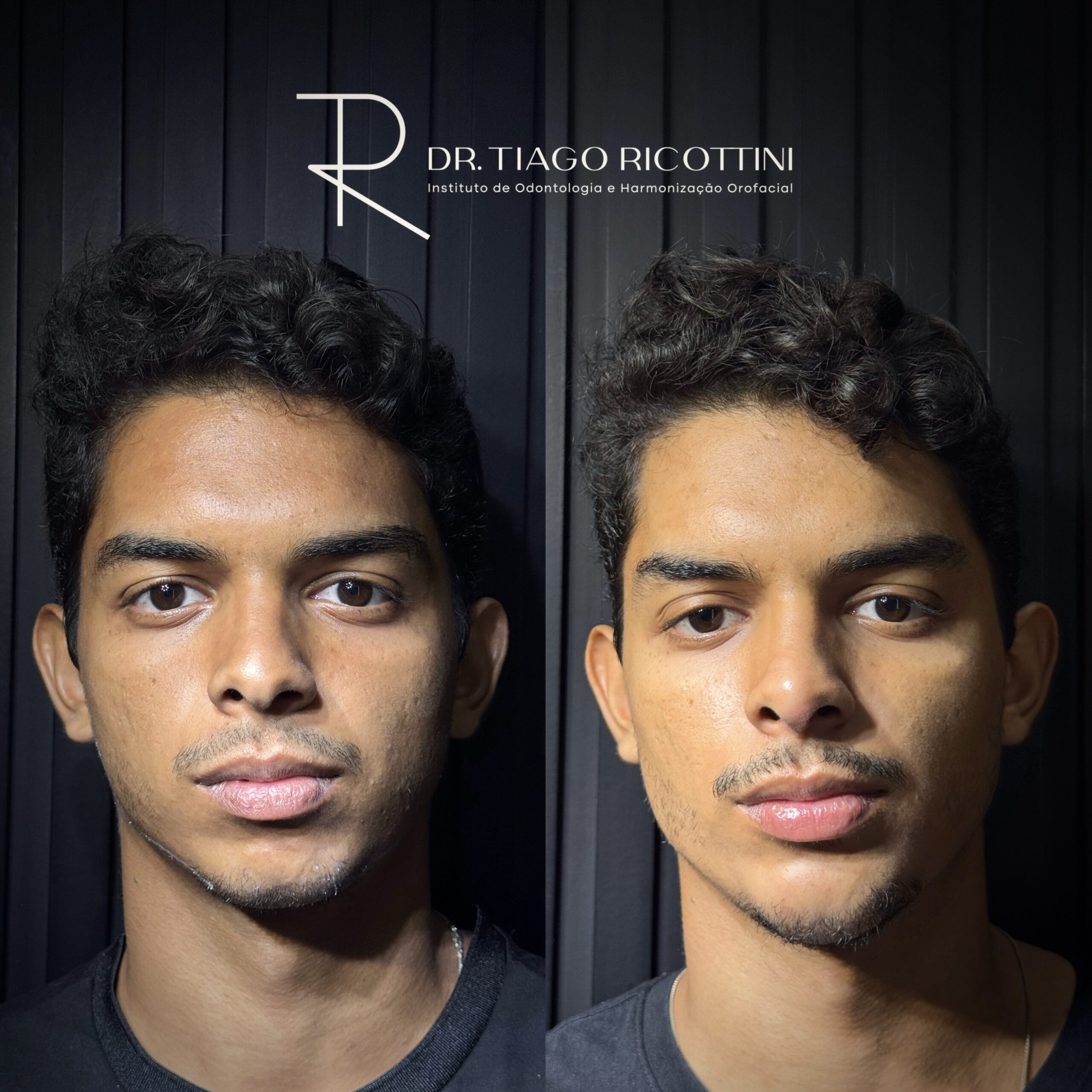 Facetune_17-03-2025-06-24-07