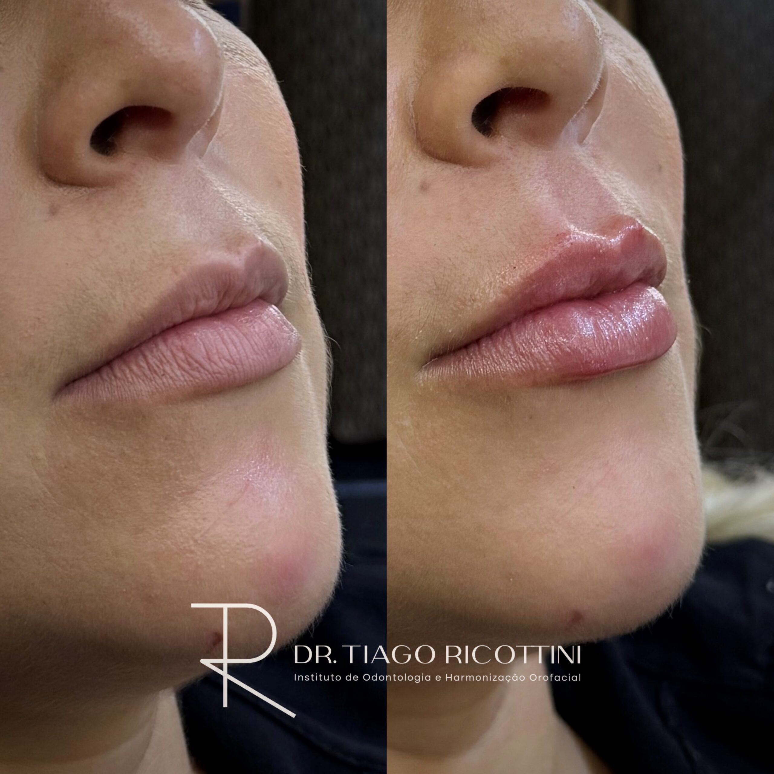Facetune_19-06-2025-17-11-09