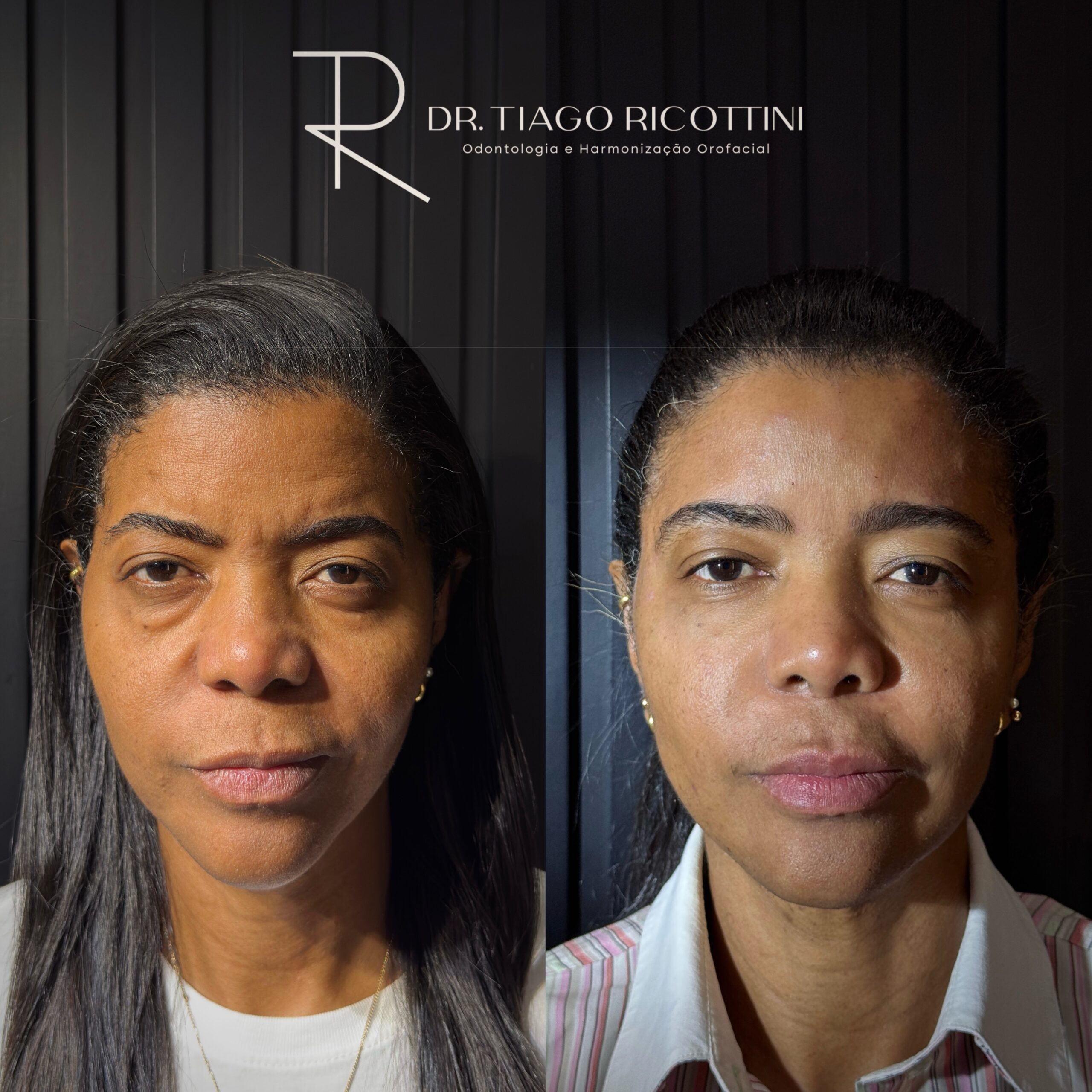 Facetune_27-05-2025-18-03-42